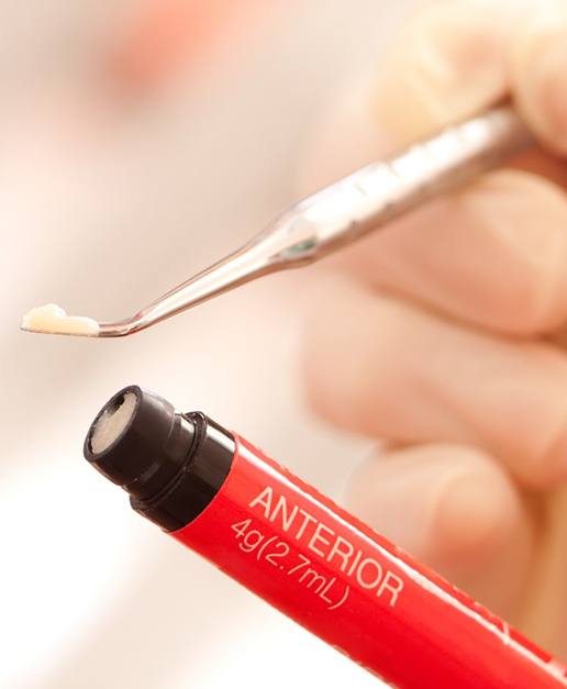 A dentist working with direct bonding’s composite resin